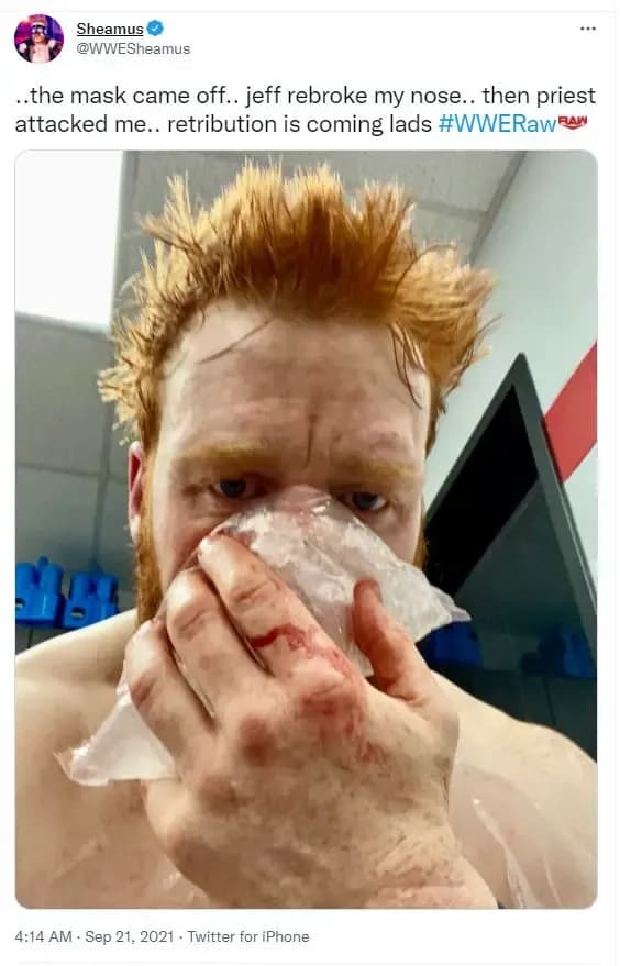 Sheamus nose tweet september 2021